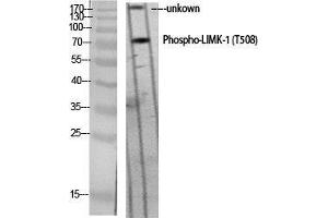 Western Blot (WB) analysis of specific cells using Phospho-LIMK-1 (T508) Polyclonal Antibody. (LIM Domain Kinase 1 抗体  (pThr508))