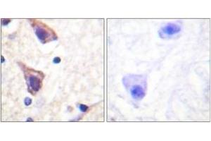 Immunohistochemistry analysis of paraffin-embedded human brain tissue, using TGF beta Receptor II (Ab-250) Antibody. (TGFBR2 抗体  (AA 191-240))