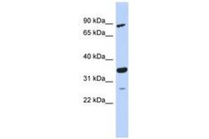 Image no. 1 for anti-PDLIM1 Interacting Kinase 1 Like (PDIK1L) (AA 179-228) antibody (ABIN6743713) (PDIK1L 抗体  (AA 179-228))