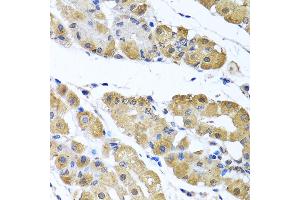 Immunohistochemistry of paraffin-embedded human stomach using OGFR antibody (ABIN6128395, ABIN6145006, ABIN6145007 and ABIN6222871) at dilution of 1:100 (40x lens). (OGFR 抗体  (AA 1-280))