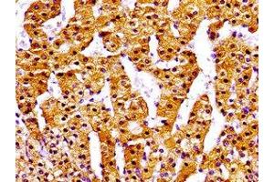 Immunohistochemistry of paraffin-embedded human adrenal gland tissue using ABIN7161727 at dilution of 1:100 (NPC1 抗体  (AA 23-269))