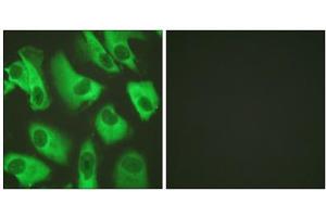 Immunofluorescence analysis of HeLa cells, using Kir5. (KIR5.1 抗体  (Ser416))