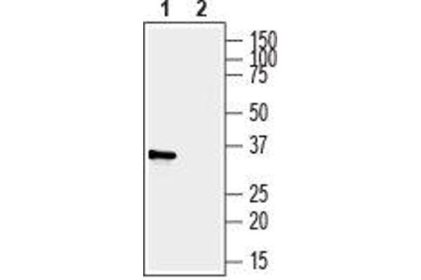 P2RY6 抗体  (2nd Extracellular Loop)