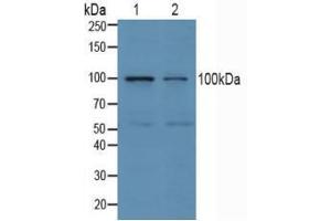 Western blot analysis of (1) Human Jurkat Cells and (2) Human K562 Cells. (ube3a 抗体  (AA 158-407))