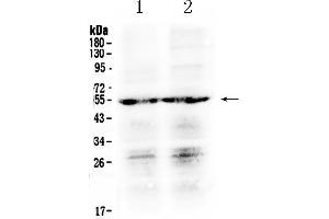 Western blot analysis of PTGER4 using anti- PTGER4 antibody . (PTGER4 抗体  (C-Term))