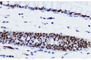 Immunohistochemistry of paraffin-embedded Human colon using Acetyl-Histone H2B-K12 Polyclonal Antibody at dilution of 1:200 (40x lens). (Histone H2B 抗体  (acLys12))