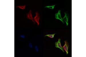 ABIN6258206 and ABIN6274351 staining Hela cells by IF/ICC. (GIT2 抗体  (Internal Region))