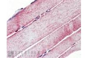 Immunohistochemistry analysis of human skeletal muscle tissue stained with Mn SOD, pAb at 10 μg/mL. (SOD2 抗体)