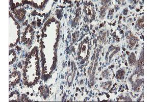 Immunohistochemical staining of paraffin-embedded Human breast tissue using anti-ACBD3 mouse monoclonal antibody. (ACBD3 抗体)