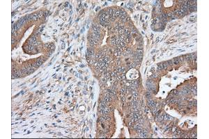 Immunohistochemical staining of paraffin-embedded Human prostate tissue using anti-SNX9 mouse monoclonal antibody. (SNX9 抗体)