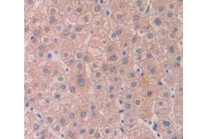 Used in DAB staining on fromalin fixed paraffin- embedded Kidney tissue (Cytohesin 4 抗体  (AA 1-379))