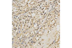 Immunohistochemistry (IHC) image for anti-Peroxiredoxin 4 (PRDX4) (AA 38-271) antibody (ABIN3022012)