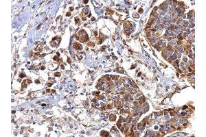 Immunohistochemistry (IHC) image for anti-Serpin Family H Member 1 (SERPINH1) (Internal Region) antibody (ABIN2855536)
