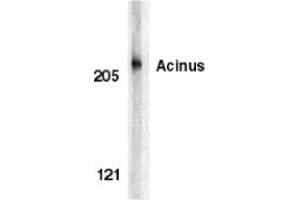 Image no. 1 for anti-Apoptotic Chromatin Condensation Inducer 1 (ACIN1) (AA 994-1009) antibody (ABIN204398) (ACIN1 抗体  (AA 994-1009))