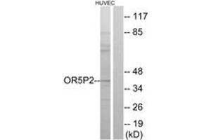Western blot analysis of extracts from HuvEc cells, using OR5P2 Antibody. (OR5P2 抗体  (AA 193-242))