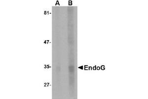 Western Blotting (WB) image for anti-Endonuclease G (ENDOG) (AA 51-140) antibody (ABIN492523) (Endonuclease G 抗体  (AA 51-140))