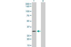 Western Blot analysis of TLX3 expression in transfected 293T cell line by TLX3 monoclonal antibody (M01), clone 2A3.
