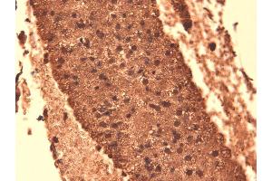 Immunohistochemistry (IHC) image for anti-Solute Carrier Family 5 (Sodium/iodide Cotransporter), Member 5 (SLC5A5) (AA 468-643) antibody (Biotin) (ABIN2484440)