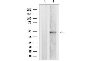 Western blot analysis of lysates from MCF7, using TRBP Antibody. (TRBP 抗体  (Internal Region))