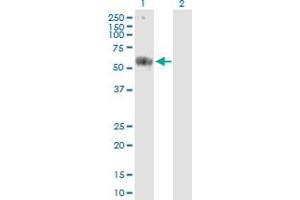Western Blot analysis of CARD9 expression in transfected 293T cell line by CARD9 MaxPab polyclonal antibody.