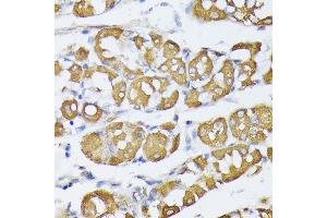 Immunohistochemistry of paraffin-embedded human stomach using VAPA antibody (ABIN6132892, ABIN6150056, ABIN6150057 and ABIN6216758) at dilution of 1:100 (40x lens). (VAPA 抗体  (AA 137-227))