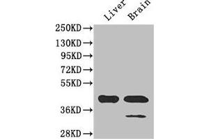 Western Blot Positive WB detected in: Mouse liver tissue, Mouse brain tissue All lanes: GLUL antibody at 3 μg/mL Secondary Goat polyclonal to rabbit IgG at 1/50000 dilution Predicted band size: 42 kDa Observed band size: 42 kDa (GLUL 抗体  (AA 86-373))