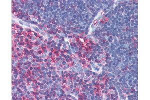 Immunohistochemistry (IHC) image for anti-Moesin (MSN) antibody (ABIN1803989)