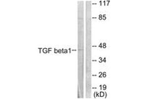 Western blot analysis of extracts from HepG2 cells, using TGF beta1 Antibody. (TGFB1 抗体  (AA 336-385))