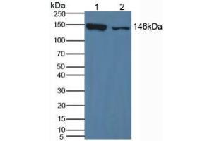 Western blot analysis of (1) Mouse Liver Tissue and (2) Mouse Lung Tissue. (XDH 抗体  (AA 231-416))