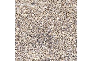 IHC analysis of SNRNP27 using anti-SNRNP27 antibody (ABIN7599614).