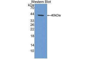 Western blot analysis of the recombinant protein. (Keratin 33A 抗体  (AA 57-363))