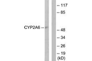 Western blot analysis of extracts from Jurkat cells, using Cytochrome P450 2A6 Antibody. (CYP2A6 抗体  (AA 1-50))