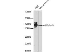Western blot analysis of extracts of various cell lines, using SET/T Rabbit mAb (ABIN7270265) at 1:1000 dilution. (SET/TAF-I 抗体)