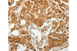 Immunohistochemistry (IHC) image for anti-Transforming Growth Factor, beta Receptor 1 (TGFBR1) antibody (ABIN2426967) (TGFBR1 抗体)