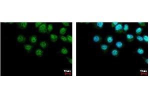 ICC/IF Image LIMD1 antibody [C2C3], C-term detects LIMD1 protein at cytoplasm and nucleus by immunofluorescent analysis. (LIMD1 抗体  (C-Term))