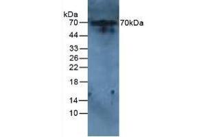 Detection of IL6R in Rat Liver Tissue using Polyclonal Antibody to Interleukin 6 Receptor (IL6R) (IL-6 Receptor 抗体  (AA 385-462))