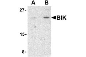Image no. 1 for anti-BCL2-Interacting Killer (Apoptosis-Inducing) (BIK) (N-Term) antibody (ABIN318742) (BIK 抗体  (N-Term))