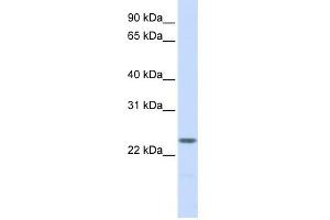 WB Suggested Anti-NPM2 Antibody Titration: 0.