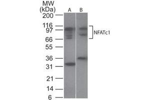 NFATc1 Western Blot.