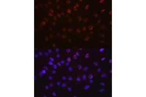 Immunofluorescence analysis of C6 cells using Aurora B antibody (ABIN7265782). (Aurora Kinase B 抗体)