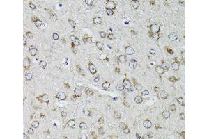 Immunohistochemistry (Paraffin-embedded Sections) (IHC (p)) image for anti-Ribosomal Protein S10 (RPS10) antibody (ABIN7010881)