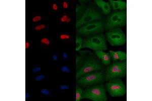 ABIN6264808 and ABIN6276442 staining  cells by IF/ICC. (RPA1 抗体  (Internal Region))