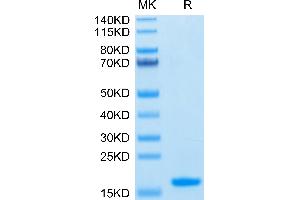 Human Nectin-4 IgV Domain on Tris-Bis PAGE under reduced condition. (PVRL4 Protein (AA 32-146) (His-Avi Tag))