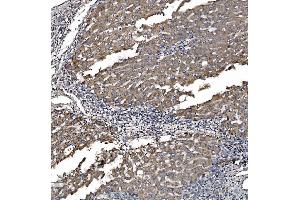 IHC analysis of Astrin/Deepest/SPAG5 using anti-Astrin/Deepest/SPAG5 antibody (ABIN7602399). (SPAG5 抗体  (AA 738-1193))