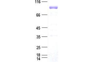 Validation with Western Blot (FOXP1 Protein (DYKDDDDK Tag))