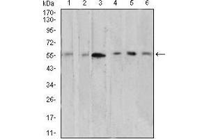 Western Blotting (WB) image for anti-V-Akt Murine Thymoma Viral Oncogene Homolog 1 (AKT1) (AA 1-150) antibody (ABIN5542264)