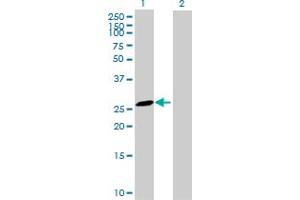 Western Blot analysis of MS4A6A expression in transfected 293T cell line by MS4A6A MaxPab polyclonal antibody. (MS4A6A 抗体  (AA 1-248))