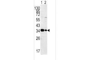 Western blot analysis of ST antibody (C-term) (ABIN392001 and ABIN2841786) in HepG2ane 1nd Hela(lane2 ) cell line lysates (35 μg/lane). (MPST 抗体  (C-Term))