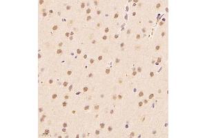Immunohistochemistry of paraffin embedded rat brain using ALS2CR13 (ABIN7073909) at dilution of 1:1800 (400x lens) (FAM117B 抗体)