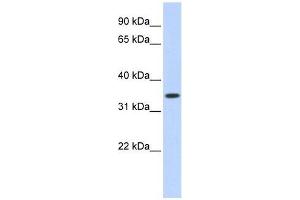 TRIM27 antibody used at 0. (TRIM27 抗体  (Middle Region))
